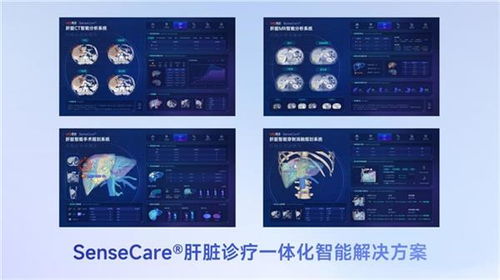 商湯醫(yī)療獲肝臟CT輔助診斷NMPA三類(lèi)證，軟硬件零售賦能肝臟診療一體化新格局